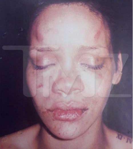 rihanna face beat up. Rihanna+eat+up+2011