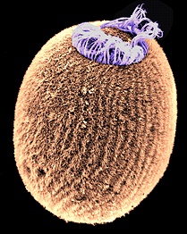 Image of a sponge larva. https://sharon-taxonomy2009-p3.wikispaces.com/Porifera 
